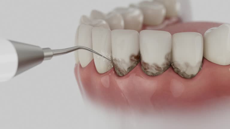 Reliable Dental Implants contractor in Fair Lakes, VA by Smile Center Dentistry
